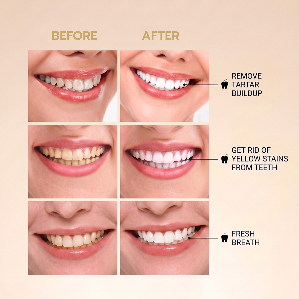 Auris Teeth Whitening Pen
